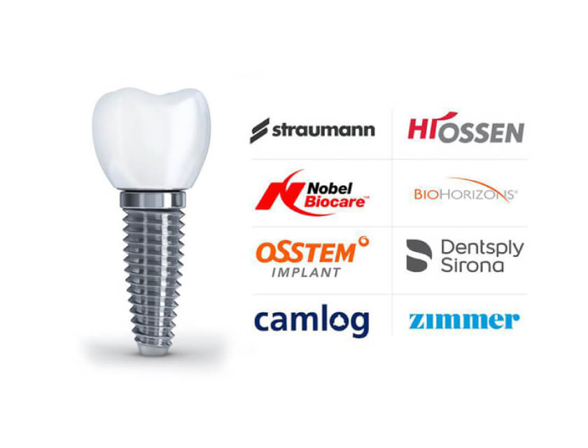 Dental Implants: A Comprehensive Guide to the Most Popular Brands